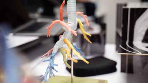 Model of the lung