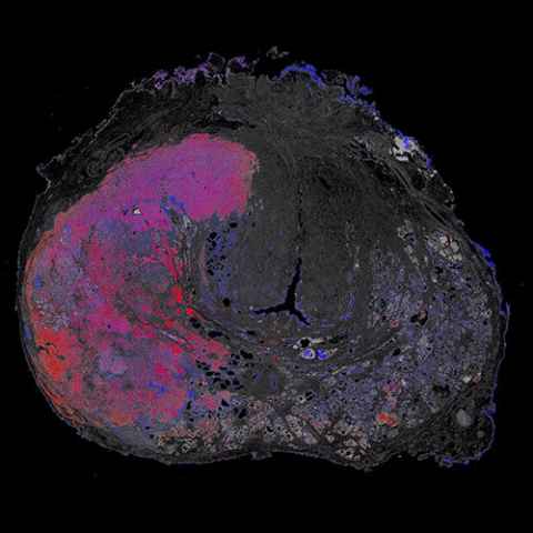 Prostate palette by Tsz Him Chan & Hayley Reynolds