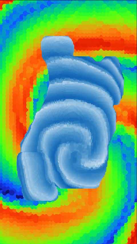 Arrhythmia by Roshan Sharma