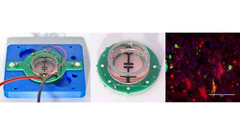 Yi-Han and Sahan are working on this project, in collaboration with Vickie Shim (ABI), and Thomas Park and Mike Dragunow (Centre for Brain Research). Yi-Han is supported by the Ministry of Business, Innovation and Employment of New Zealand’s Catalyst Fund, and Sahan is supported by a University of Auckland doctoral scholarship.
