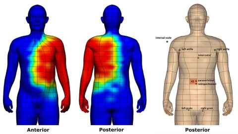 Figure 1: Heat maps displaying the likelihood of lymphatic drainage to the left armpit (left) and an interactive tool predicting the sentinel node location based on a selected skin region (right).