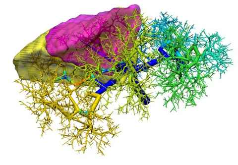 Fig. 1: CCO algorithm is used to extend the portal veins and to simulate the Couinaud segments. There are ~8,000 vessel segments in this portal tree.