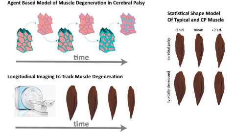 Figure 3: CP muscle degrades over time at both the cellular and tissue level. We use biomechanical modeling based on finite elements and agent-based modeling to probe the nature of degeneration at the cellular level. With longitudinal imaging, we can probe degeneration and impaired growth in whole muscles in CP. Statistical shape models are used to quantify the differences in shape between typical and CP muscles.
