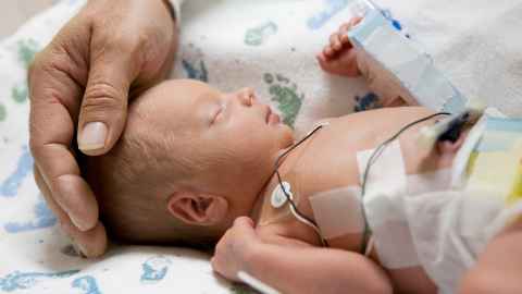Preterm baby on blanket being touched on head by parent