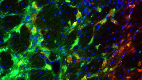 Transplanted neuron cells in a rat brain.