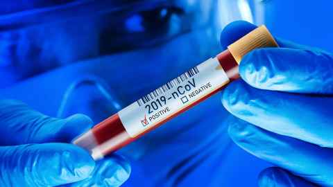 A worker in PPE holding a blood sample labelled '2019-nCoV Positive'.