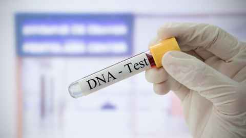 A gloved hand holding a test tube labelled 'DNA - Test'.