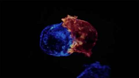 CAR T-cells attacking cancer cells.
