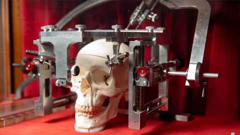 Neurosurgeon Graeme Macdonald's steriotactic frame from the 1940s to 1950s