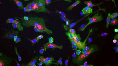 Brain cells under the microscope.