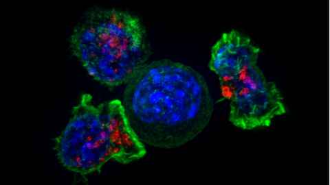 CAR T-cell therapy is one of the most promising treatments for cancer.