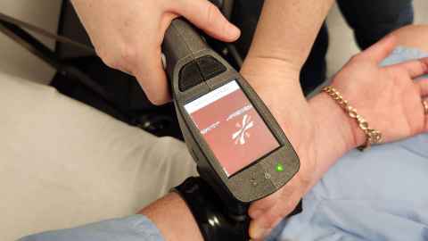 Prototype of skin cancer scanner