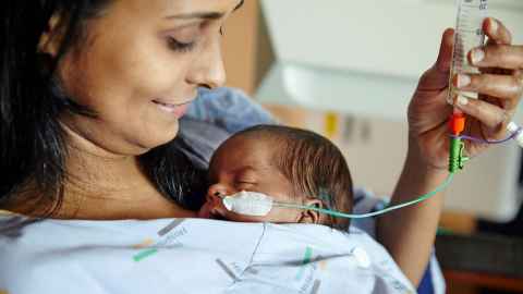 Mum cuddles baby with feeding tube