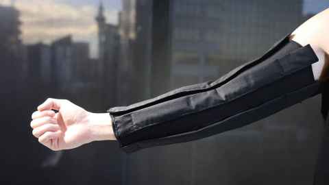 arm fitted with black wrap-around sleeve/cuff pressure garment.