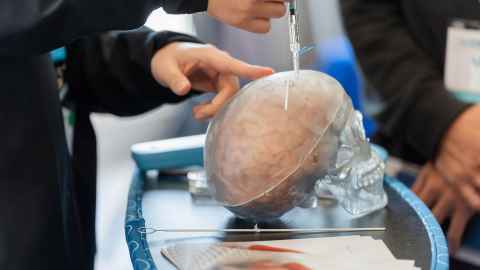 model of a skull with the sensor being inserted