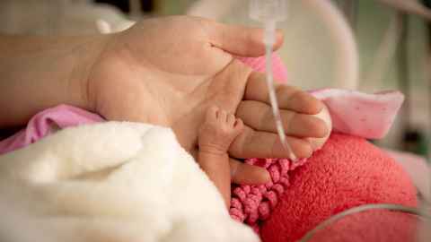 image of extremely tiny baby's hand, held by adult hand