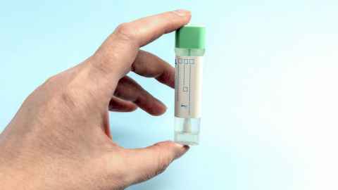 Close up of FIT test tube