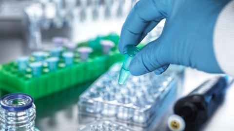 Photo of a lab with test tubes, generic