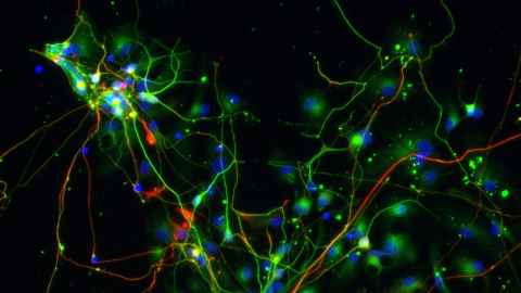 Human neurons (green), with a sub set of dopamine neurons (red)